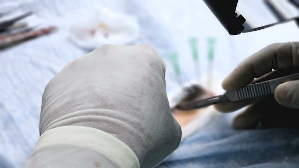 Minor Surgery