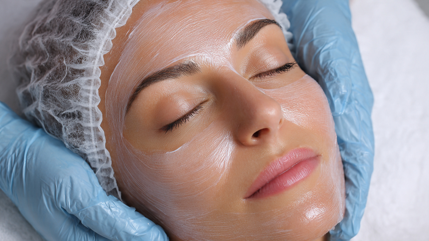Chemical Peels